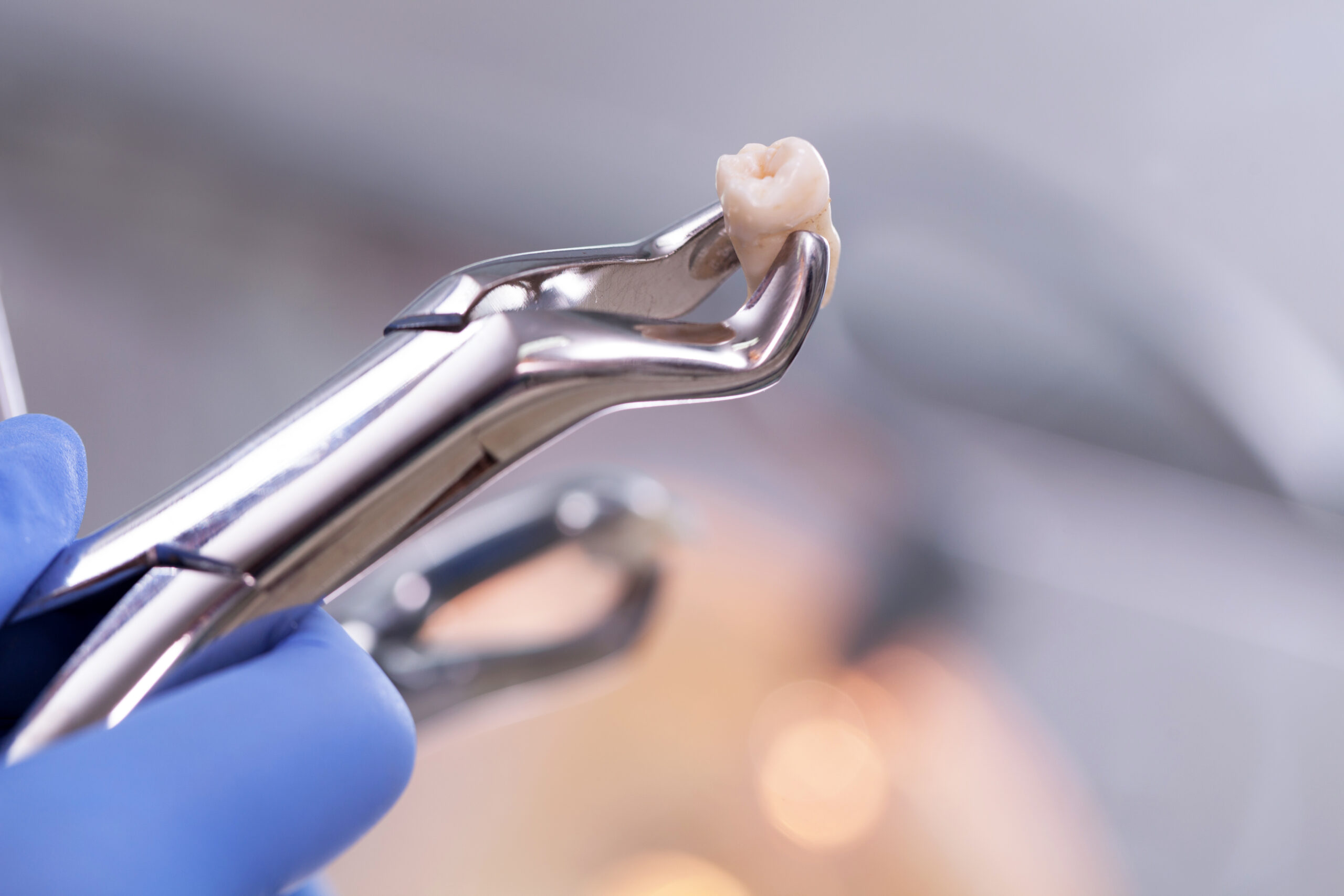 bowling green ky dental extraction
